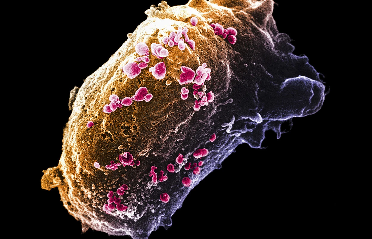 Image: Scanning electron micrograph of HIV virus particles on a lymphocyte. Credit: FOX-NCI/PHANIE/Science Photo Library